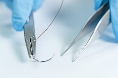 What is Surgical Suture?